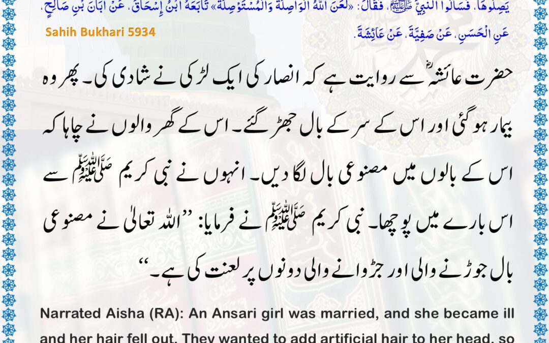 Sahih Bukhari – 5934